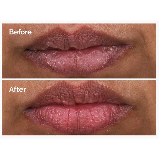 PHA 5% Exfoliating Lip Serum