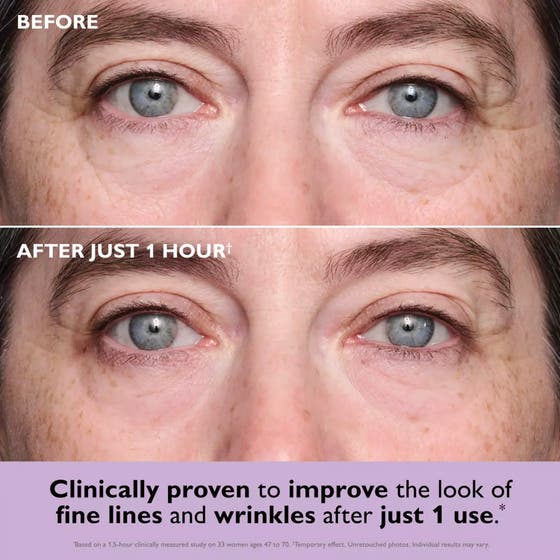 Instant FIRMx® Collagen Infusion Tightening Eye Patches