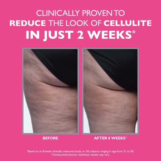 Firmx® Tight & Toned Cellulite Treatment