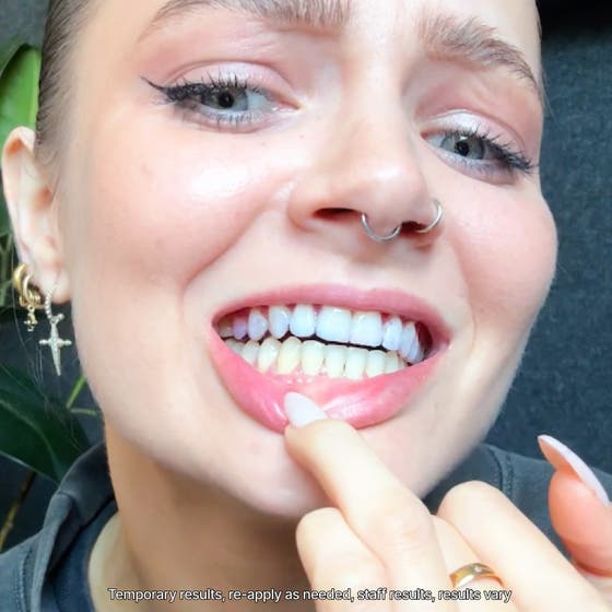 V34 Teeth Whitening Strips