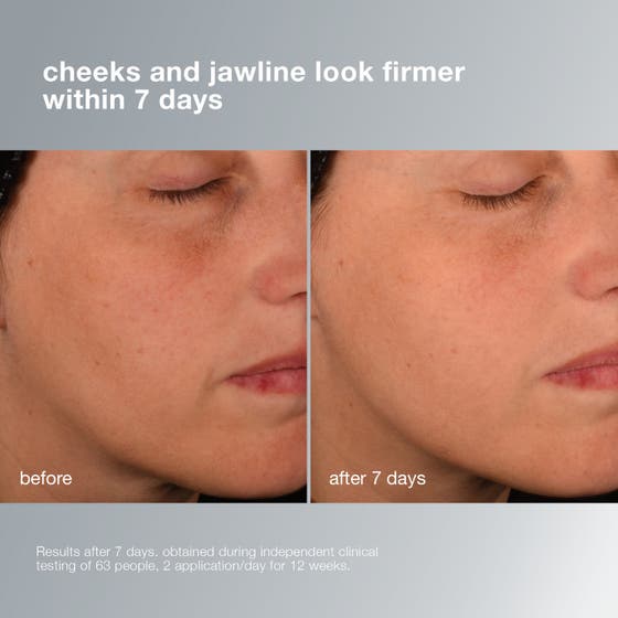 Dermalogica Pro-Collagen Banking Serum 30 ml serum för fastare hud visar resultat på kinder och käklinje efter 7 dagar