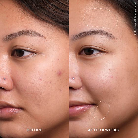 Detox & Glow - Avgiftande och Lystergivande Behandling för Män med Trött Hy