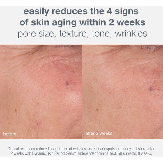 Skin Aging Solutions