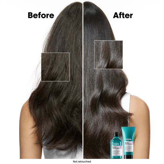 Scalp Advanced Anti-Discomfort Shampoo