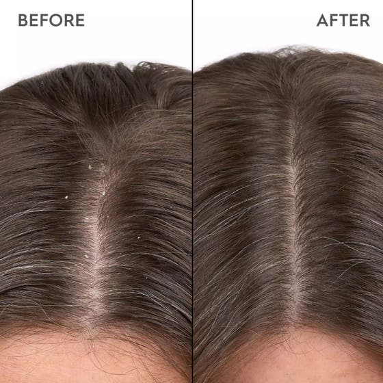 Kerasilk Anti-Dandruff Scalp Serum 100ml