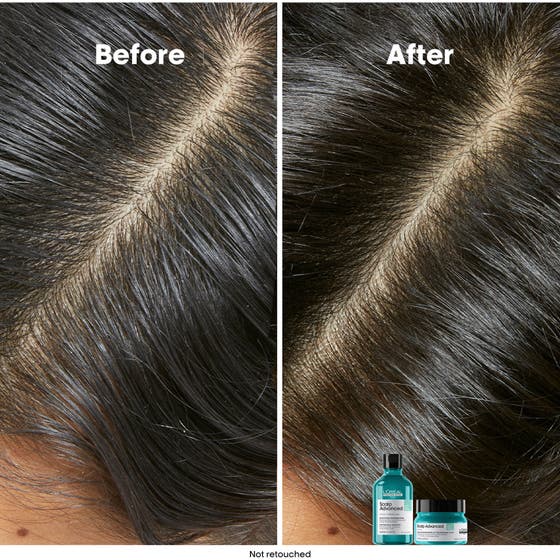 Scalp Advanced Anti-Oiliness Shampoo