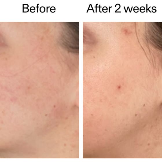 360 Skin Clearing Serum