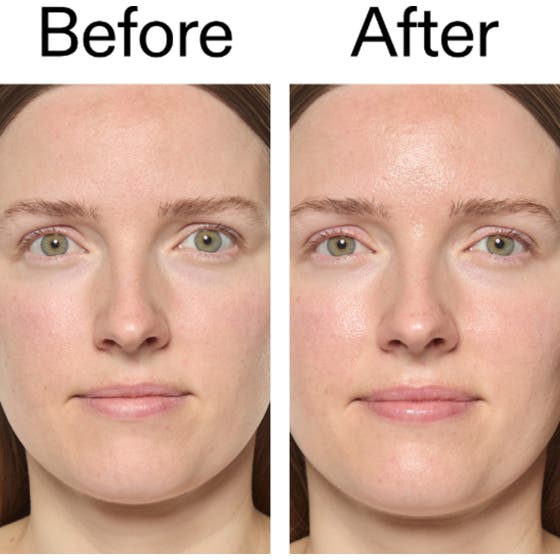 Exosome Hydro-Glow Complex