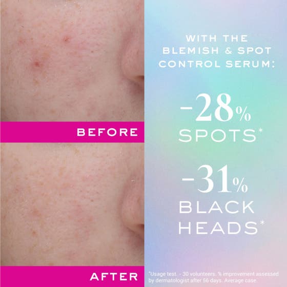 Nuxe Zinc Power Blemish And Spot Control Serum 30 ml mot orenheter i en iriserande kartong med rosa text.