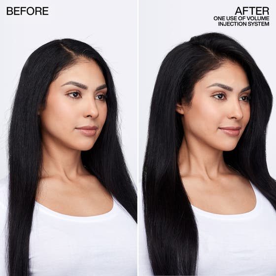 Volume Injection