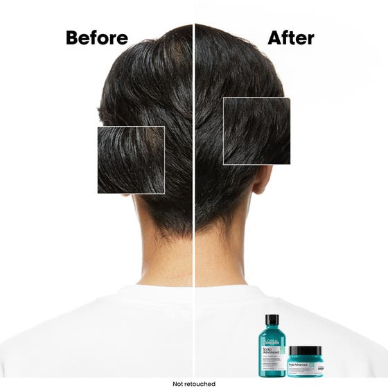 Scalp Advanced Anti-Oiliness Shampoo