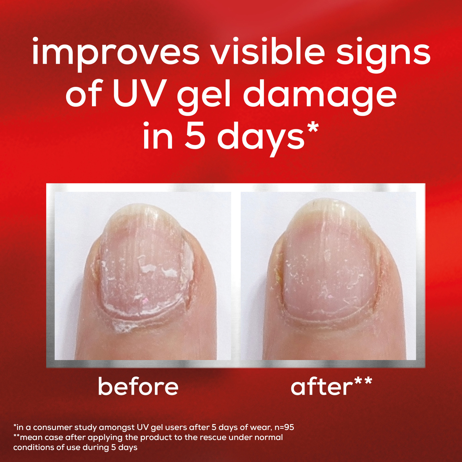 to the rescue UV gel damage repair