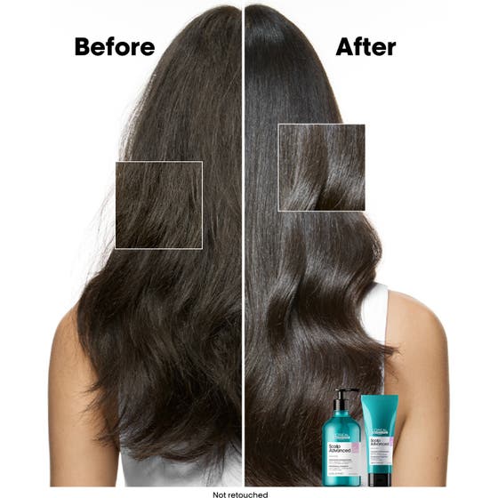 Scalp Advanced Anti-Discomfort Treatment