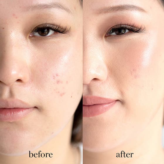 Quinoa Water Foundation