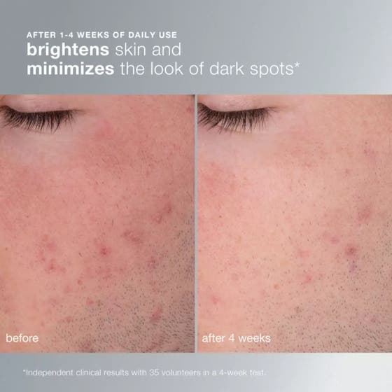 Dermalogica Daily Microfoliant 74 g risbaserad peeling i vit flaska som ger lyster, polerar och jämnar ut huden.