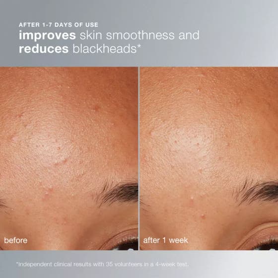 Dermalogica Daily Microfoliant 74 g daglig mikropeeling som visar vit pulverstruktur och krämigt lödder.