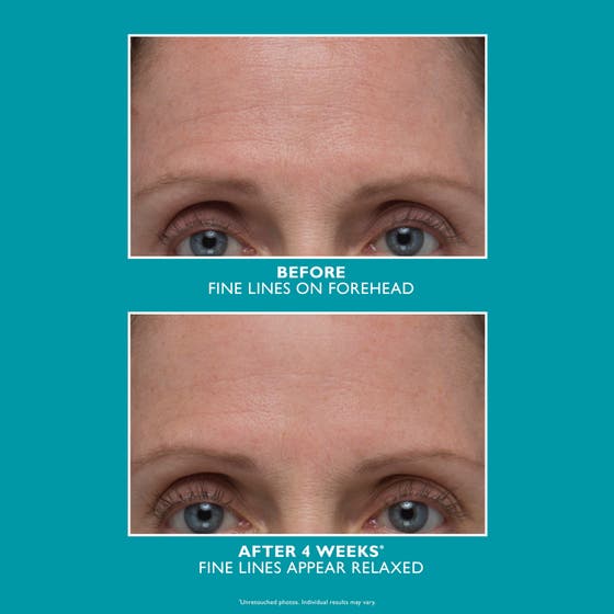 Peptide Skinjection™ Amplified Wrinkle-Fix Serum