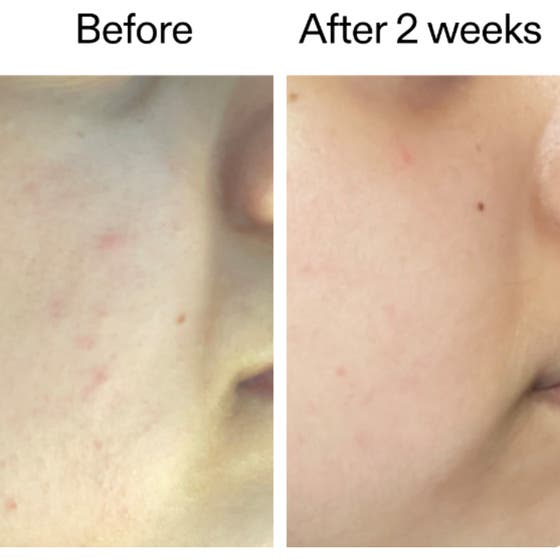 360 Skin Clearing Serum