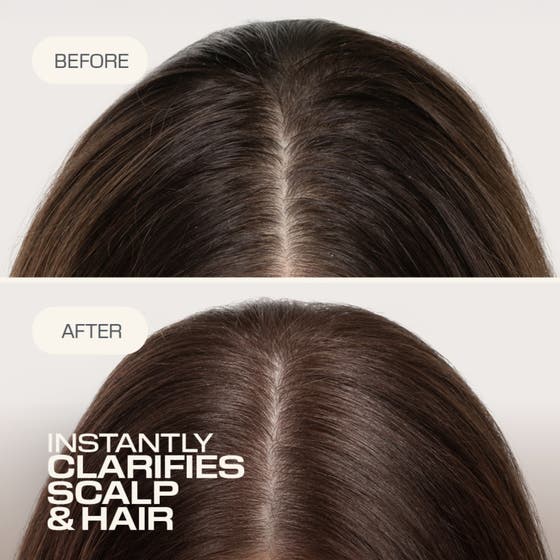 Dualsenses Scalp Specialist Clarifying Shampoo