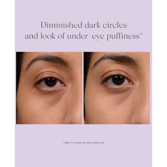 Bright Eyes Dark Circle Corrector