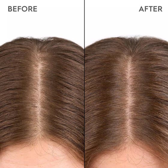 Kerasilk Moisturizing Scalp Drops 100ml