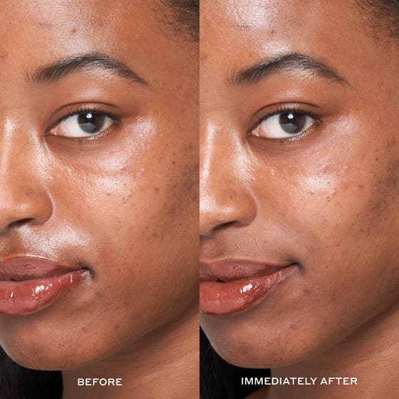 Transform Dewtopia 25% Acid Flash Facial