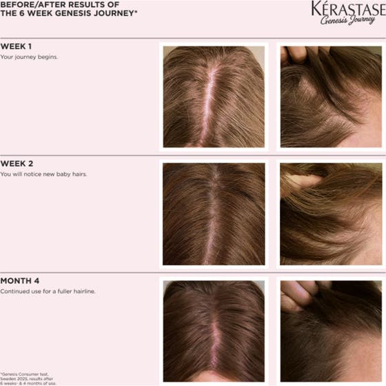 Genesis Serum Anti Chute Fortifiant