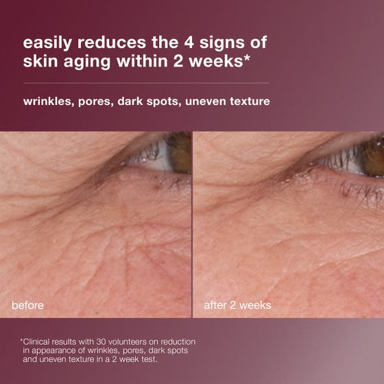 Dermalogica Dynamic Skin Retinol Serum 30 ml rynkserum som appliceras på huden med texten 3.5% high-dose retinol