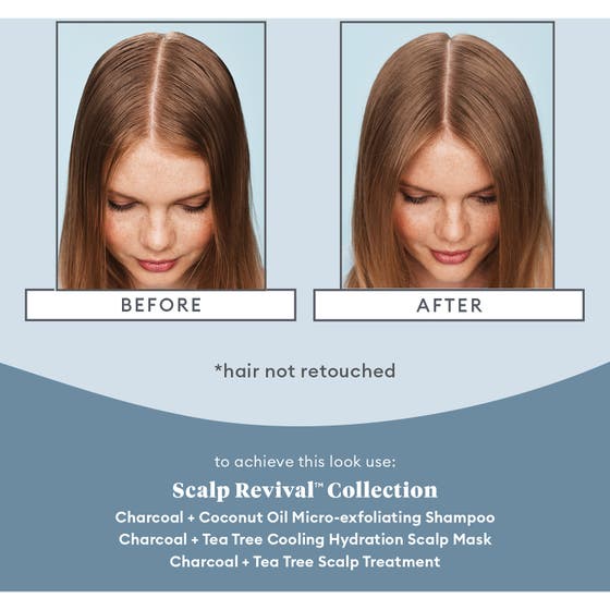 Scalp Revival™ Scalp Soothing Solutions Set