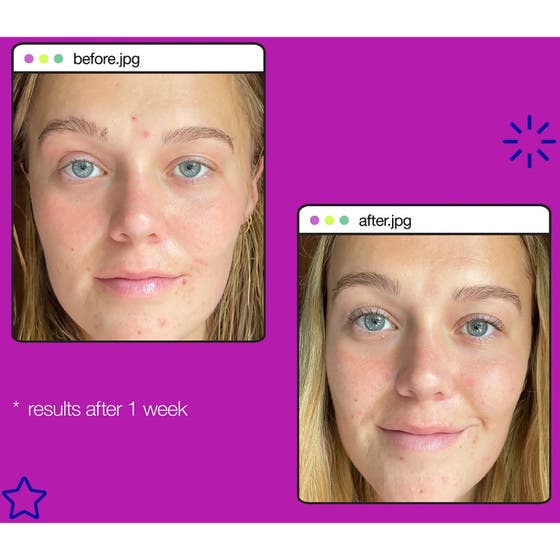 Post-Breakout Fix Duo