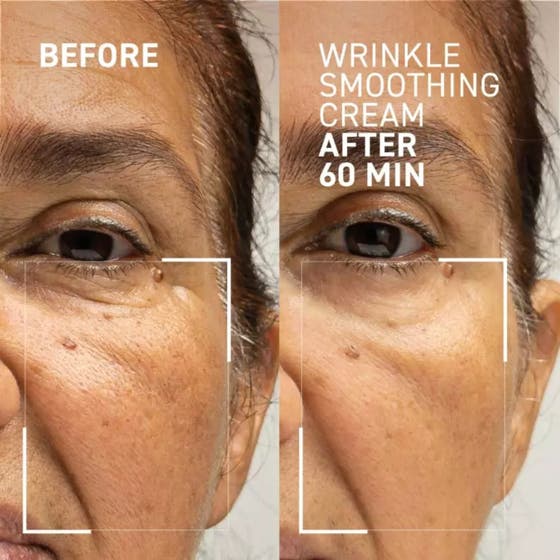 Wrinkle Smoothing Cream