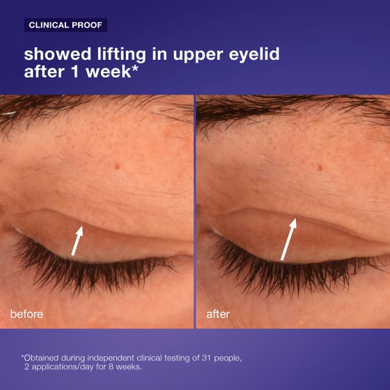 Dermalogica Phyto Nature Lifting Eye Cream 15 ml ögonkräm visar kliniska resultat för lyft och färre rynkor