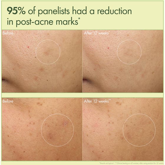 Dr. Weil Mega-Mushroom Dark Spot Brightening Moisturizer