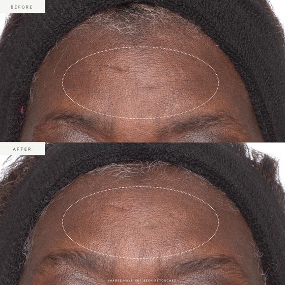 Plant Stem Cell Retinol Alternative Moisturizer