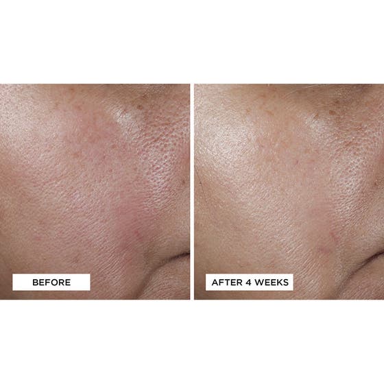 No:Rinse Intensive Pore Minimizing Toner