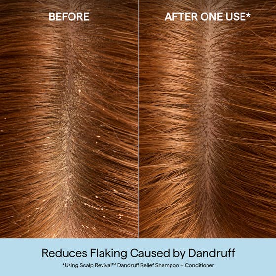 Scalp Revival™ Dandruff Relief Conditioner