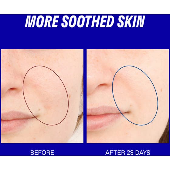 Smart Yoghurt™ Probiotic Super Serum