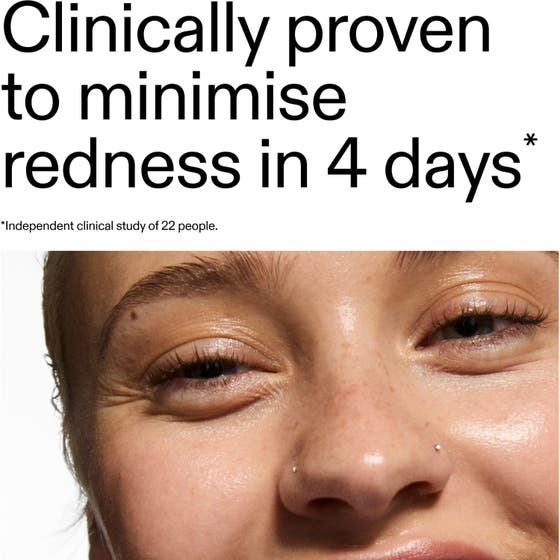 Azelaic Acid 10% Serum