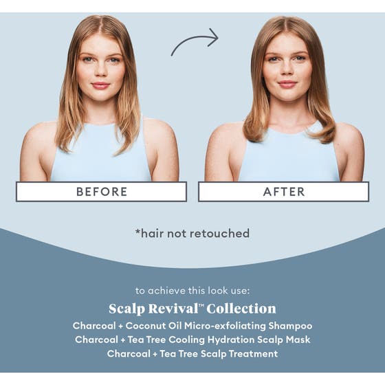 Scalp Revival™ Scalp Soothing Solutions Set