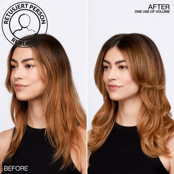 Volume Injection