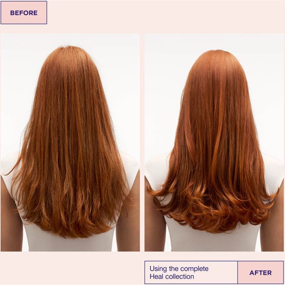 Head & Hair Heal Kit