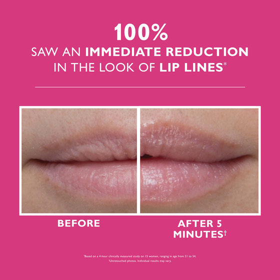 Instant Firmx® Lip Filler