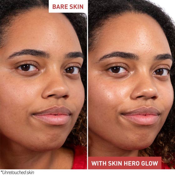 Skin Hero Glow