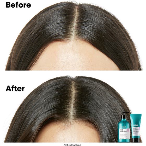 Scalp Advanced Anti-Discomfort Treatment