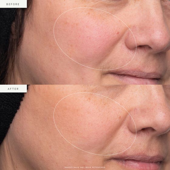 Refill - Turmeric Glow Moisturizer