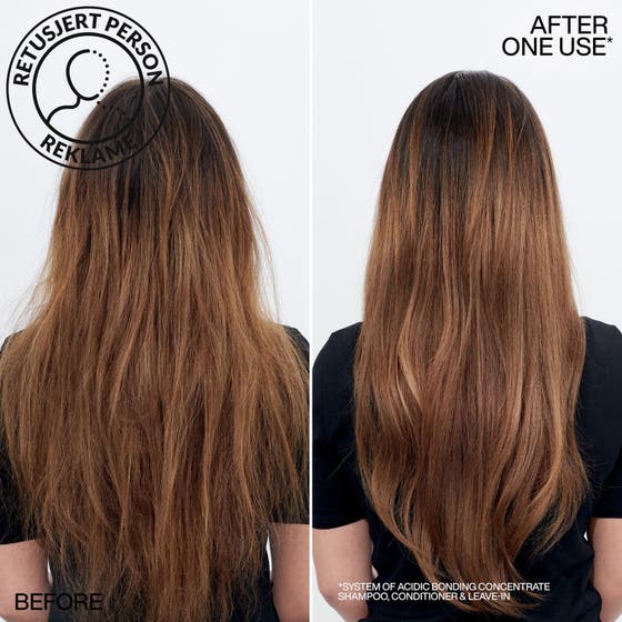 Acidic Bonding Concentrate Set