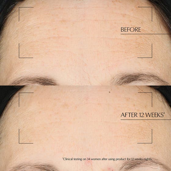 Overnight Reset - Premium Nattbehandling för Män som Vill Vakna med Förnyad Hy