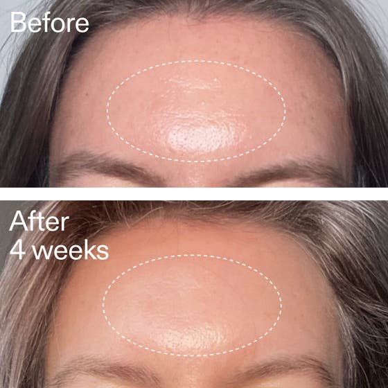 Advanced Retinal Serum