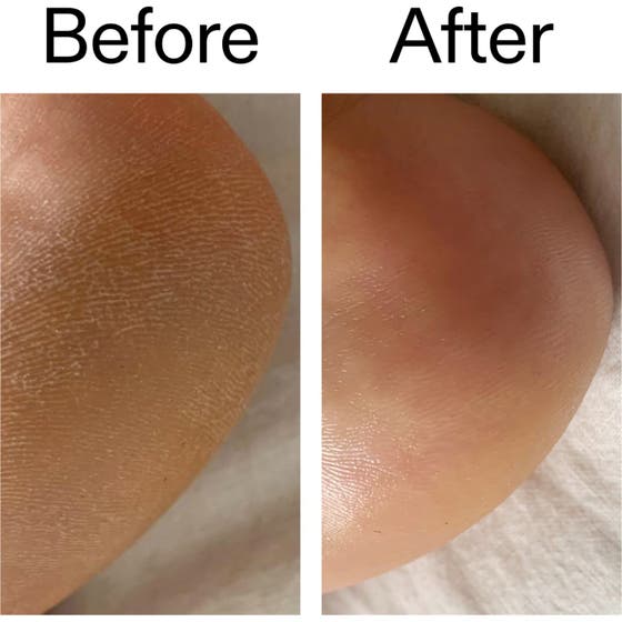 Glycolic Acid Exfoliating Body Stick