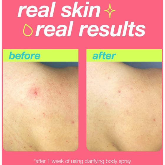 Clarifying Body Spray Duo